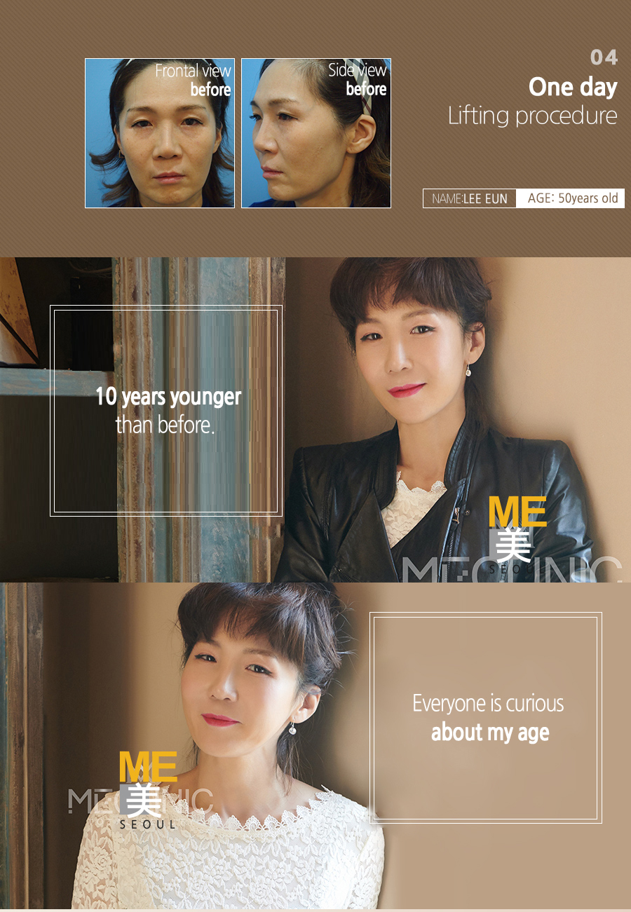 ME CLINIC seeks a SEOUL. Three main process components