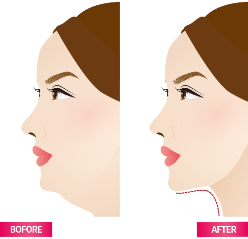 Trusculpt